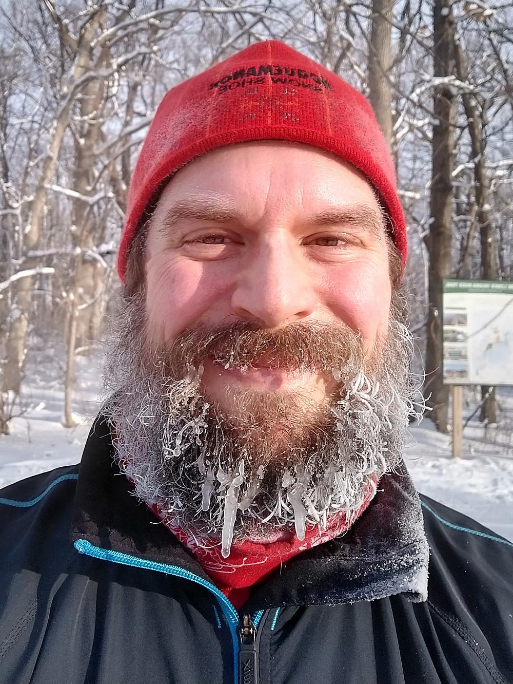 Sporting an ice beard